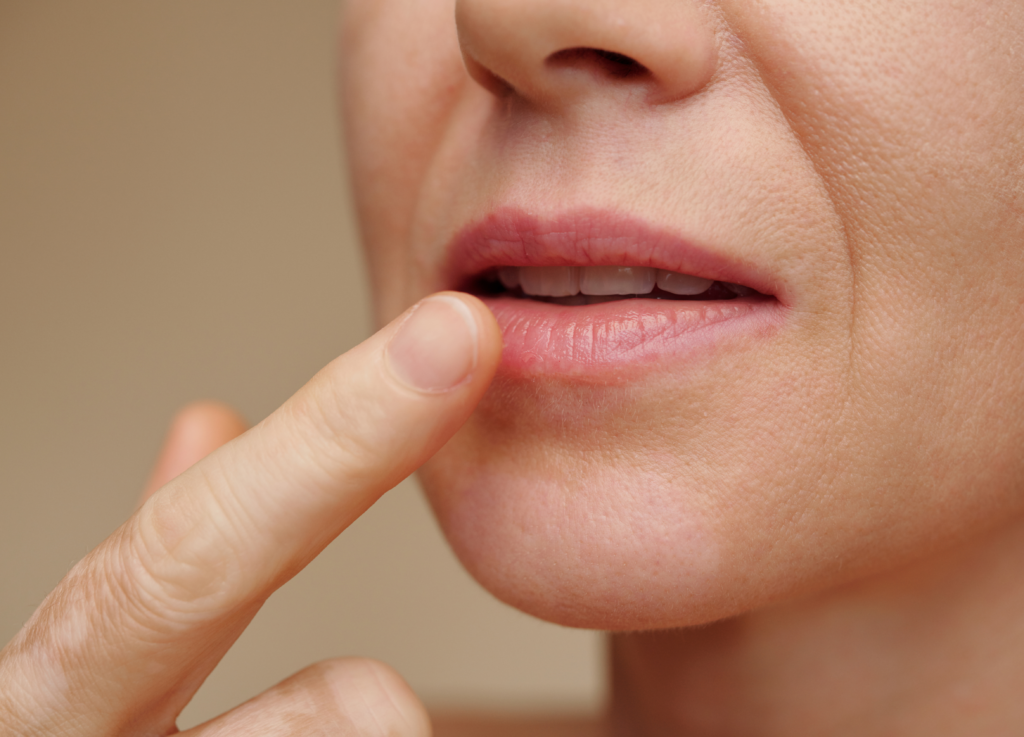 Descubra como manter os lábios hidratados e saudáveis com 5 dicas simples para o dia a dia. Cuide da sua saúde labial de forma prática e eficiente!